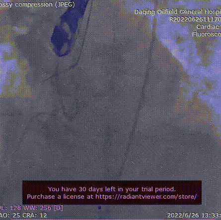 ２.gif